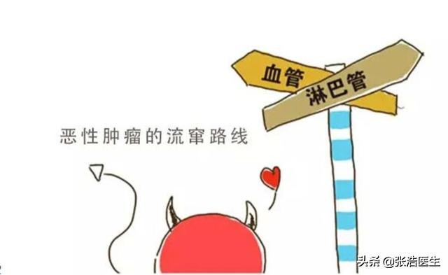 早期宫颈癌会转移成肺癌吗,宫颈癌转移至胸椎能治好吗