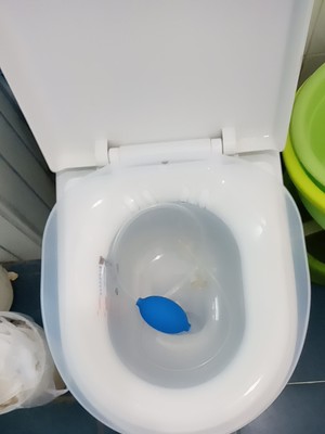 关于肛瘘的故事简短,关于肛瘘的症状及治疗方法