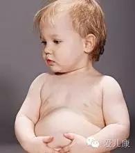 宝宝屁多屁臭大便臭,宝宝屁多拉屎有酸臭味