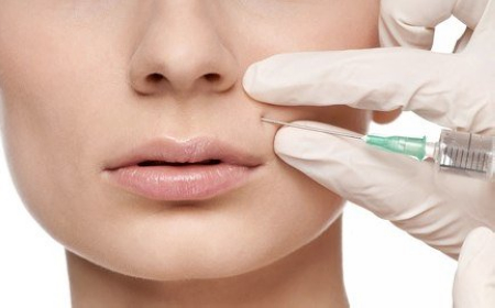 打败毛孔!下一个反孔精英就是你!