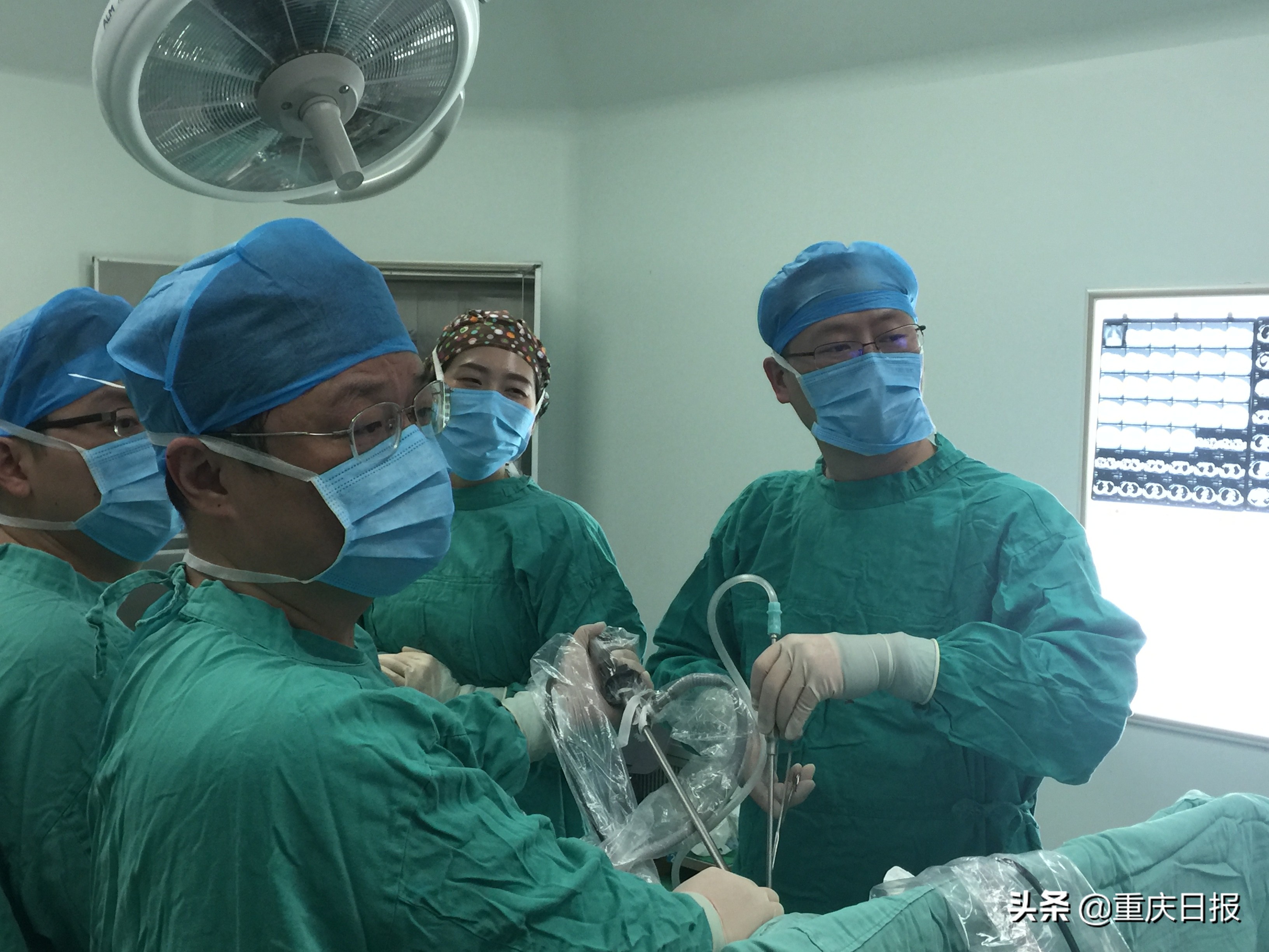 体检肺部有磨玻璃结节是什么情况,第一次体检发现3mm磨玻璃样结节