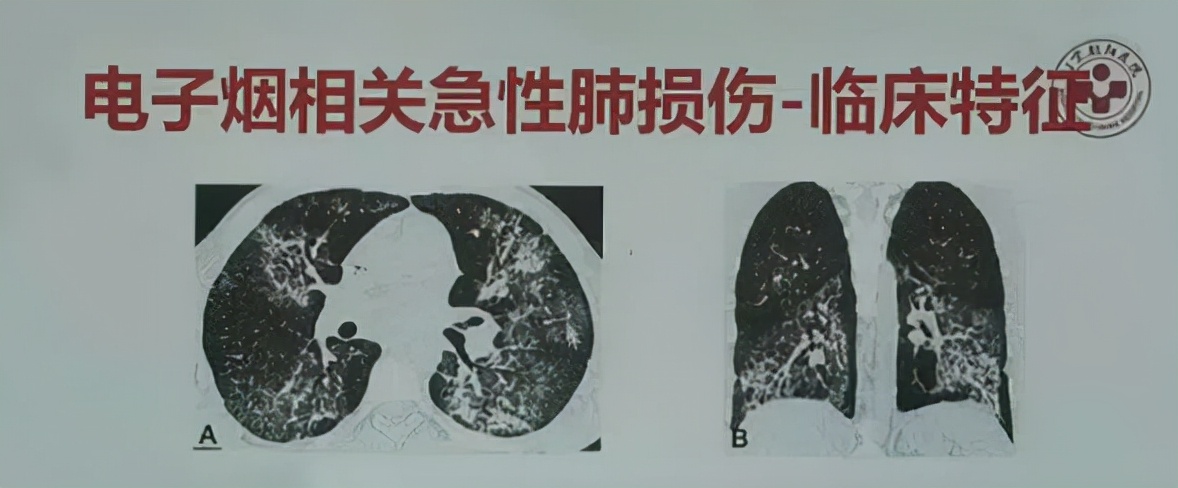 你抽的*子烟电**，让这个湖南老板身家640亿