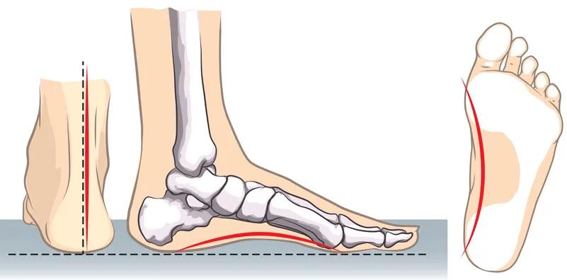 鞋头翘度一般多少,鞋尖翘度