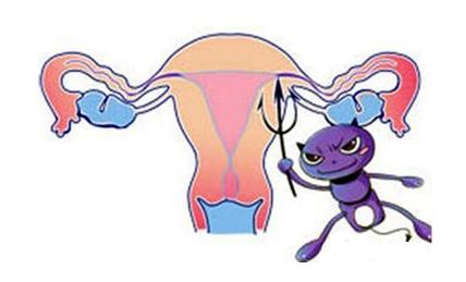 女人*处私**总是有异味？提醒：谨防与3个疾病有关，早预防