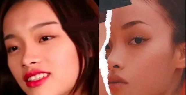 凸嘴的五官比例,宽眼距塌鼻梁凸嘴