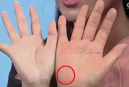 手的10大疾病征兆,手诊10种常见病从手上就能看出来