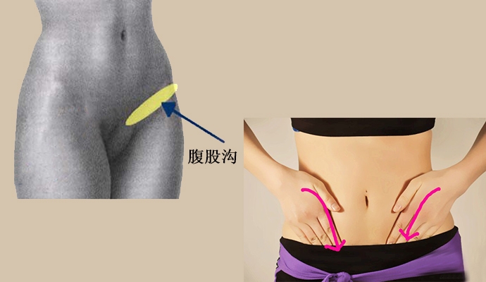人类的腹股沟是什么地方，会得什么病，很多人都不清楚