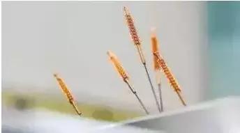 一针疗法全套视频大全,史上最快扎针