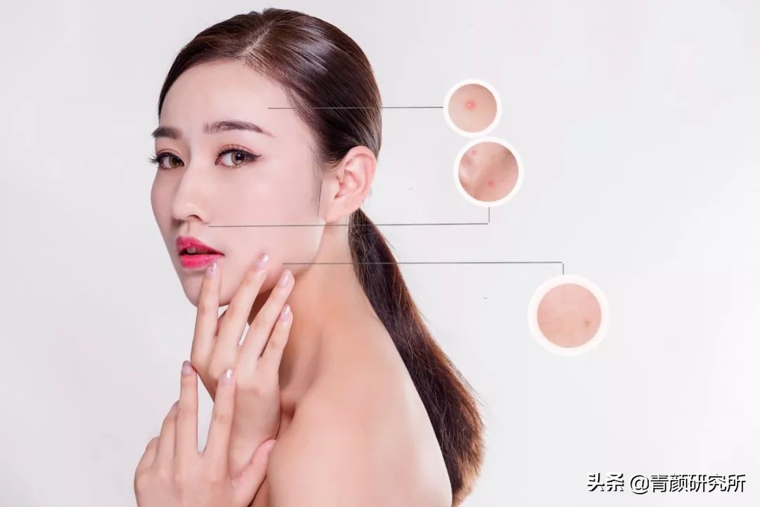 修复角质层薄红血丝敏感肌擦什么,角质层薄红血丝敏感肌肤用什么药