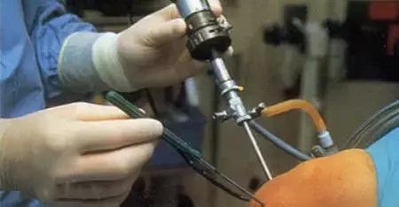 为什么医生不建议做关节镜,骨科新手对关节镜的初步认识