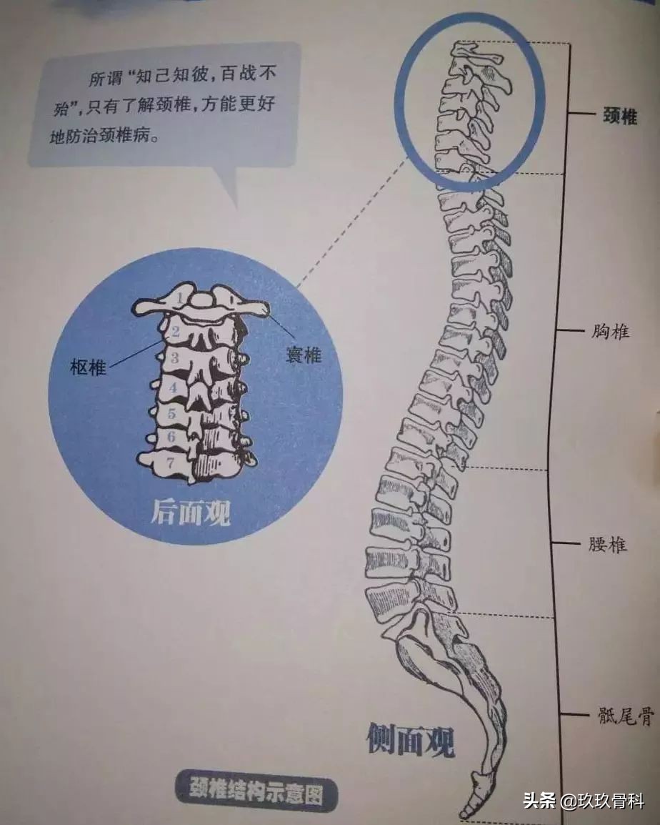 颈椎治疗法——麦肯基疗法
