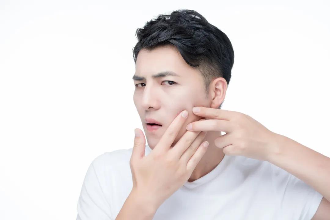 痘印痘坑毛孔粗大怎么消除,青春期留下的痘印痘坑怎么消除