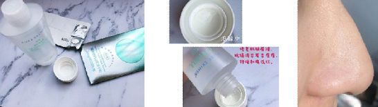 怎么去黑头黑头越来越少,黑头很多去黑头有效办法