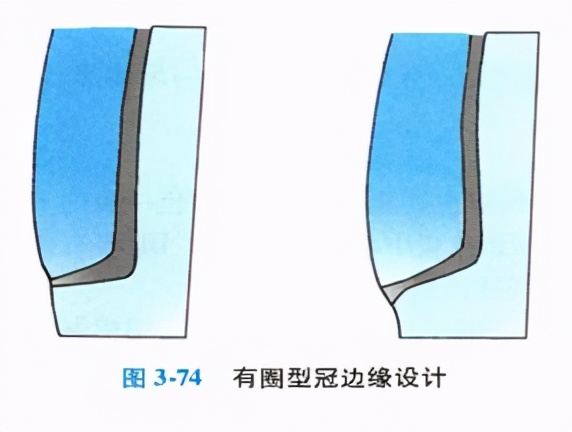 口腔金属冠与全瓷冠的区别,牙科医生讲义