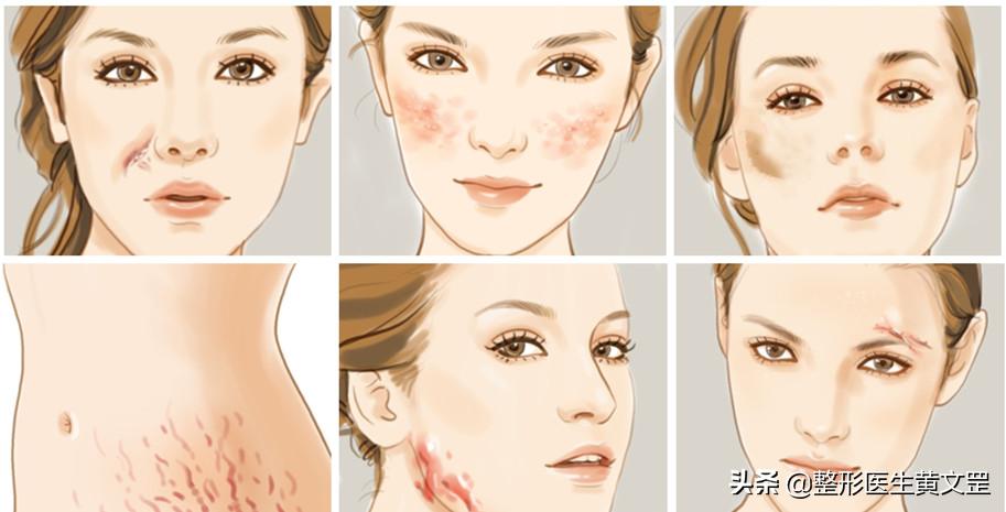 祛疤痕一站式修复,疤痕修复能完美吗