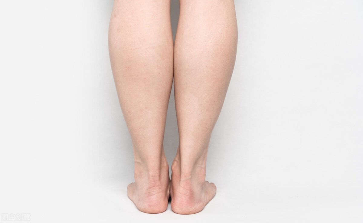 摆脱萝卜腿让小腿更细长,改善萝卜腿最好的方法