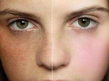 女人嘴周围长斑是什么原因,50岁女人长斑什么原因