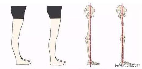 女孩子腿粗怎样变细学生党,女孩子腿粗怎么办