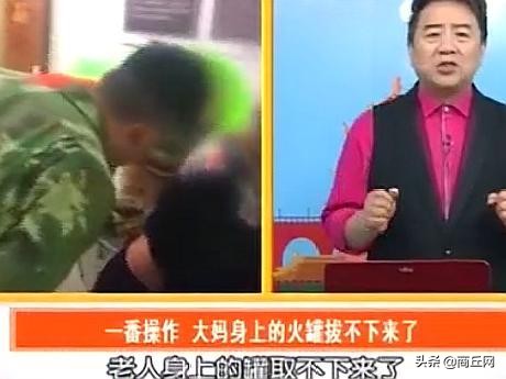 大妈在街头拔火罐,大妈拔火罐