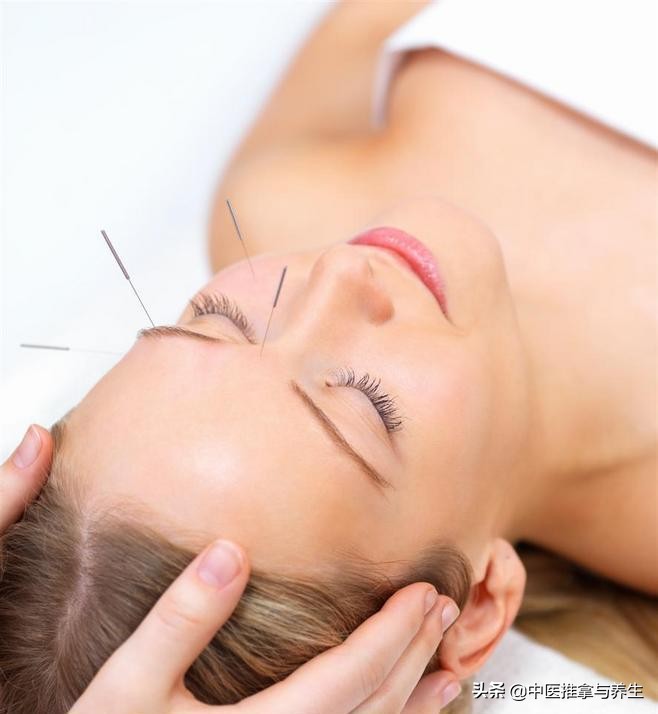 针灸祛痘去哪里做,针灸如何祛痘