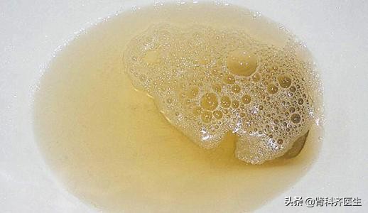 一张图看懂蛋白尿,蛋白尿的中医认识