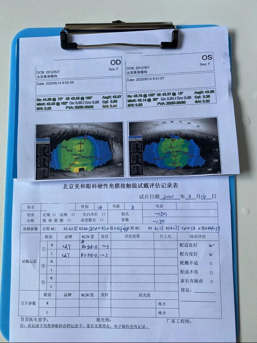 我的天!8岁暖暖竟然150度真性近视了