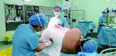 剖宫麻醉令妻儿变傻？医生有话要说