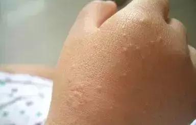 梅雨季节除虫小妙招,梅雨季节如何防霉防菌