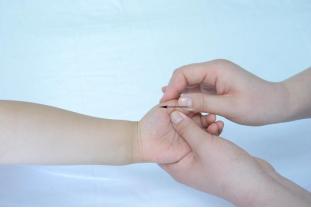 济宁推拿小儿斜颈,医院小儿推拿夜间门诊