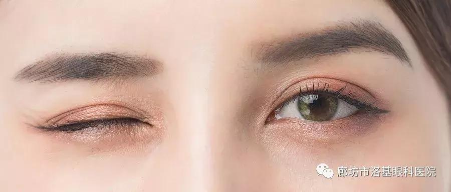 眼睛干涩模糊是哪些疾病引发的,眼睛干涩痒警惕什么疾病