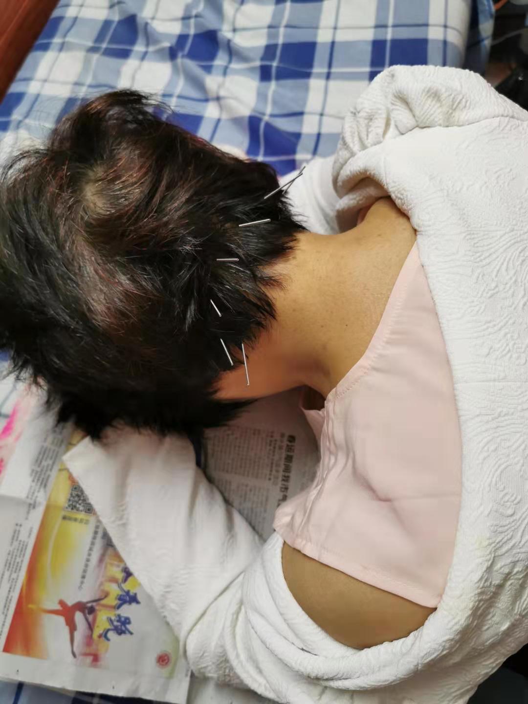 多年的颈椎病终于治好了,一个小诀窍治好了我多年的颈椎病