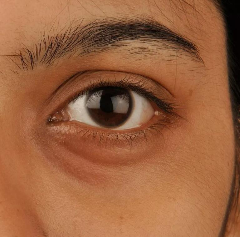 学她这样保养，50岁都不会有黑眼圈，秘密全靠这支「小黑管」