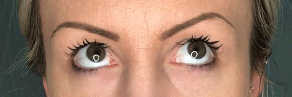 长期开车眼睛疲劳有什么好办法,长期开车有助于恢复视力