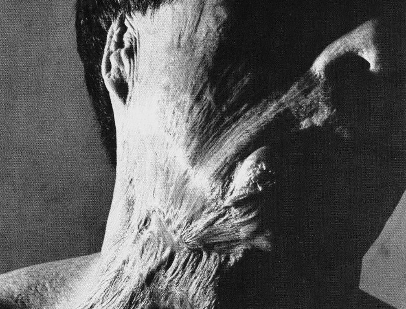 如果发生核爆该怎么保住小命,如果发生核爆炸该怎么办