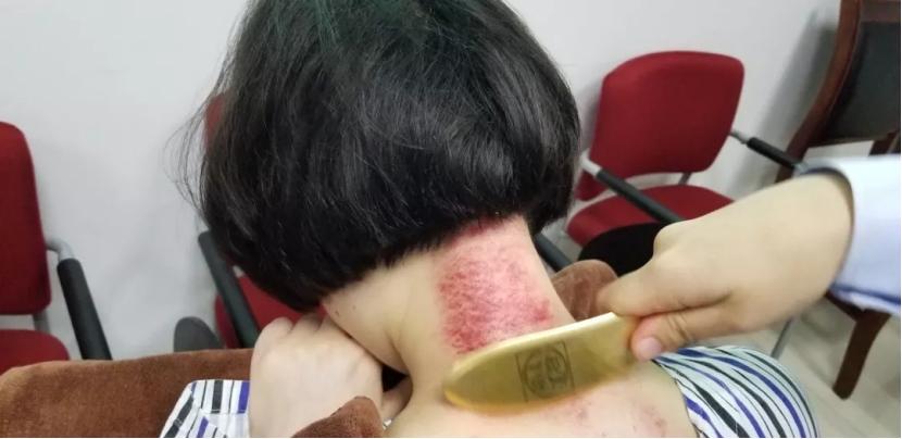 感冒对症治疗简易图表,感冒用什么方法来治呢