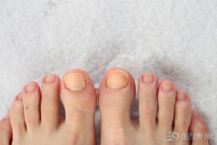 脚气脚臭洗脚水里放什么,用什么洗脚治脚气脚臭