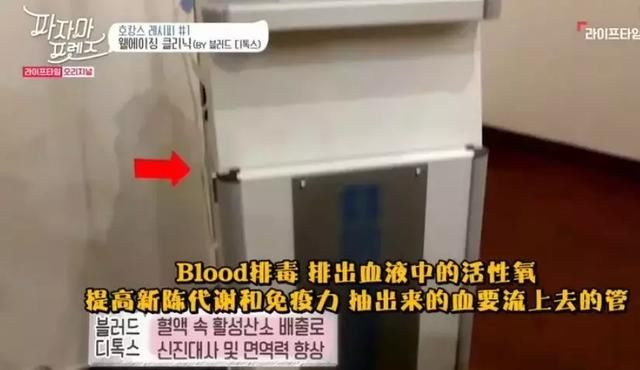 花三万换血15次,一周两次换血净化血液垃圾