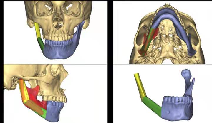 解决未满足口腔健康需求的新工程方法