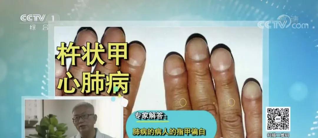 快低头看看你的手指属于什么样的,看一看你的手指是哪个类型的