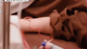 花三万换血15次,一周两次换血净化血液垃圾