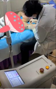 祛除腋臭,沈阳去除腋臭留下的疤痕