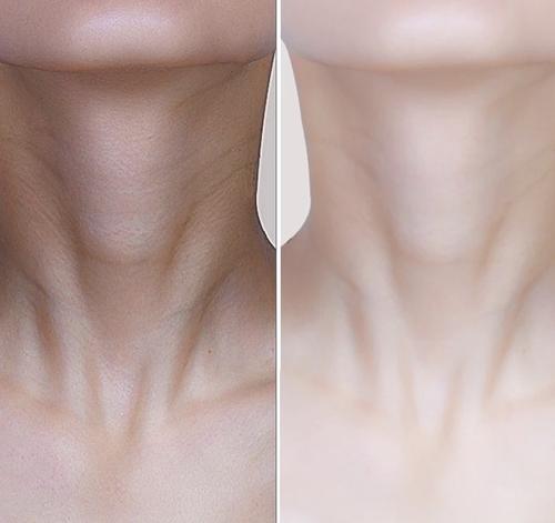 有了颈纹是衰老的标志,为什么有颈纹就显老