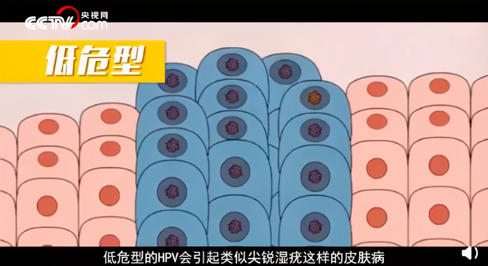 生娃后,4种妇科病别乱治!花了冤枉钱还伤身体