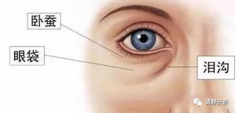 黑眼圈熊猫眼怎么补救,为什么有的人不熬夜也会有黑眼圈