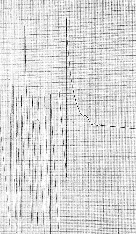 用天文望远镜看美国登月痕迹,国家望远镜是否看到了美国登月