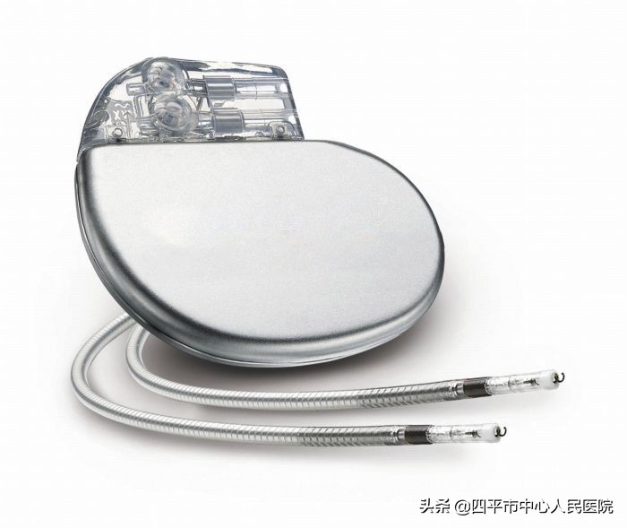 起搏器安装后要注意什么,加装心脏起搏器注意事项