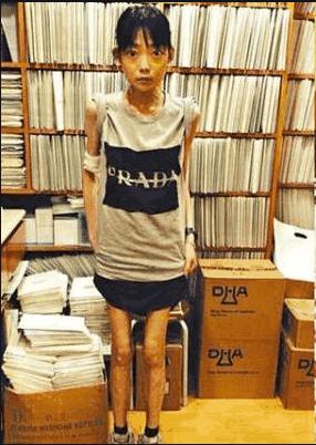 为嫁豪门穿了30年瘦身衣,22岁嫁入豪门减肥暴瘦44斤