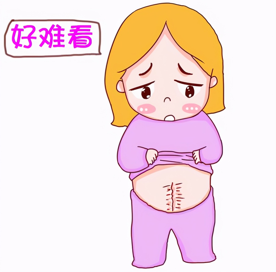 剖腹产后疤痕护理,剖腹产后疤痕护理指南