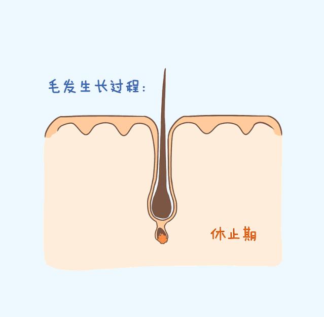 脱毛激光,脱毛各种方式比较