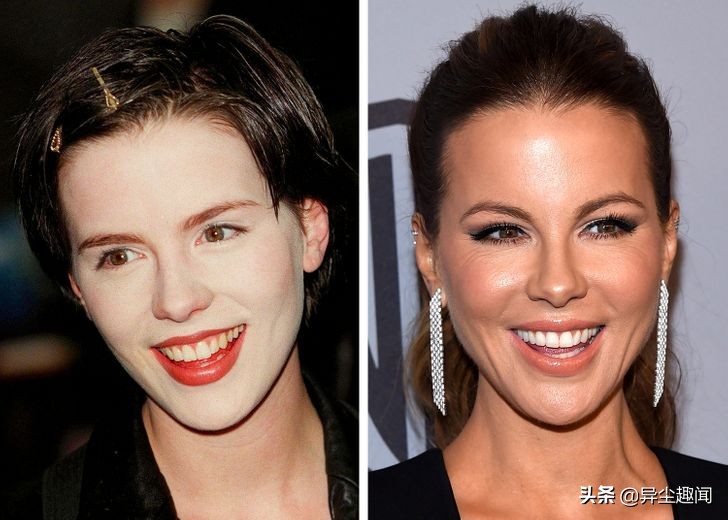 做牙齿美白的明星,明星的牙齿美白